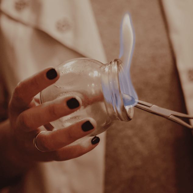 Ventouses posées sur le dos lors d'une séance de médecine chinoise